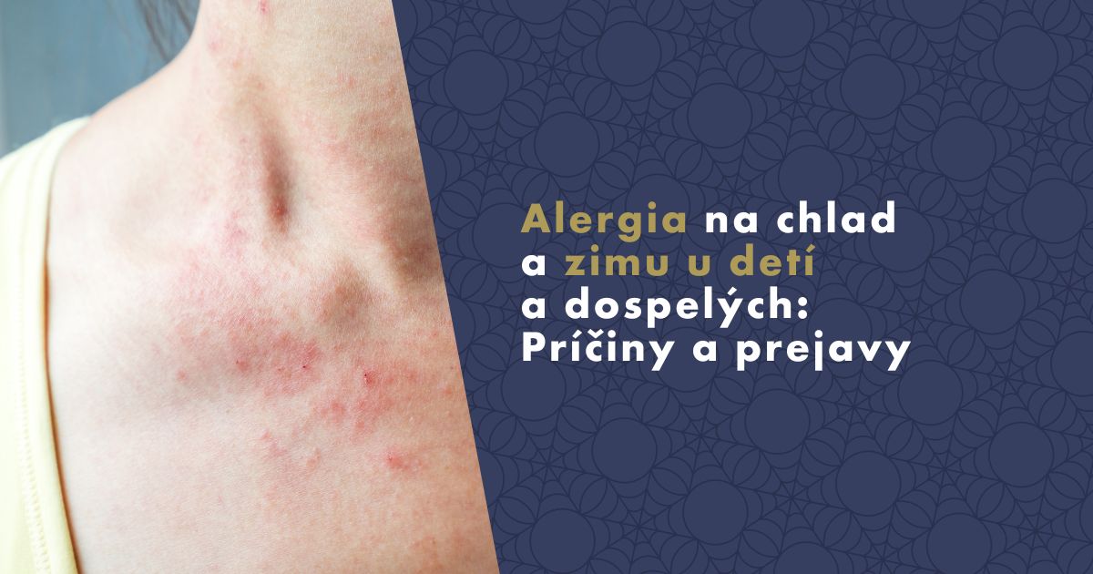 alergia-na-chlad-a-zimu (1)